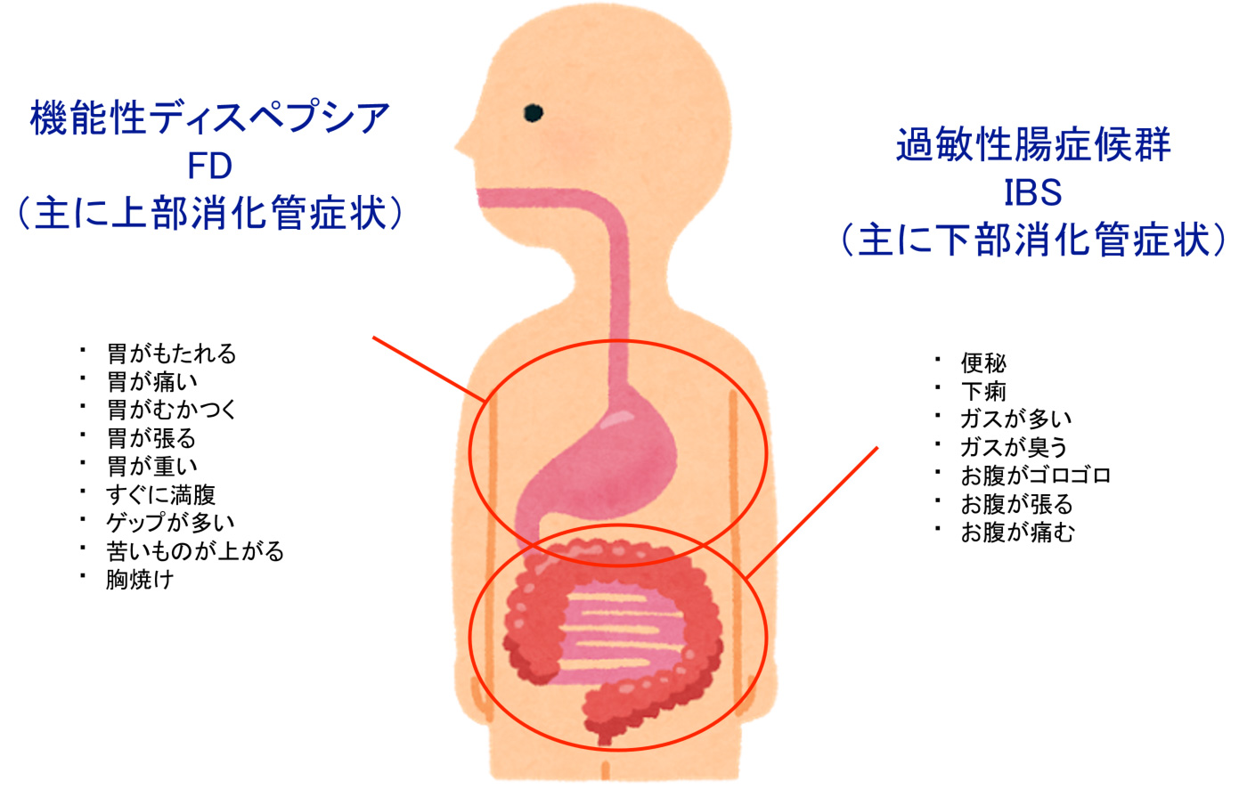 ibs とは 電源