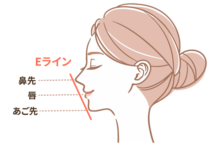 矯正で出っ歯を治すと顔は変わる?