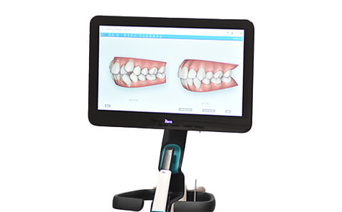 iTero(口腔内スキャナー)