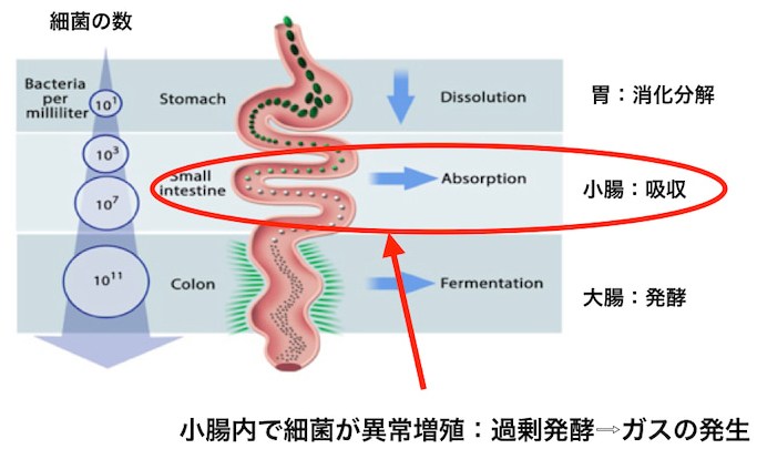 過敏性腸症候群(IBS)と小腸内細菌異常増殖症(SIBO)の関係